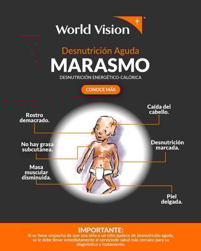 Desnutrición Marasmo